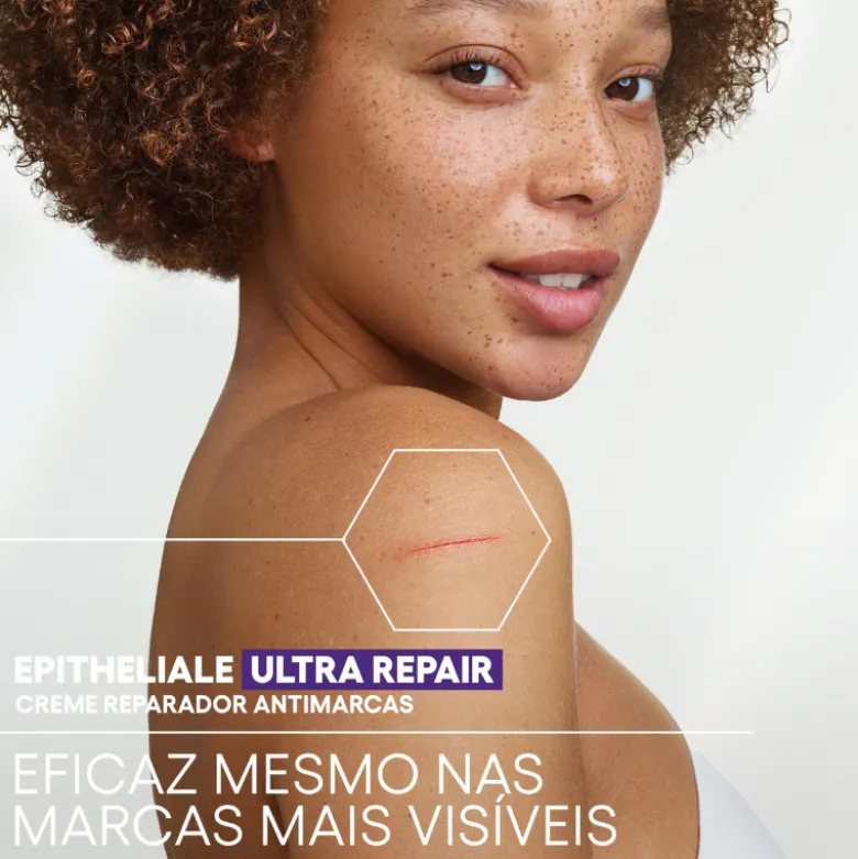 A-Derma Epitheliale A.H Ultra Creme Reparador 100ml | Antimarcas