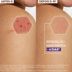 A-Derma Epitheliale A.H Ultra Creme Reparador 100ml | Antimarcas
