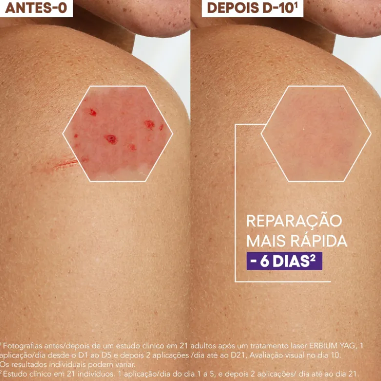 A-Derma Epitheliale A.H Ultra Creme Reparador 100ml | Antimarcas