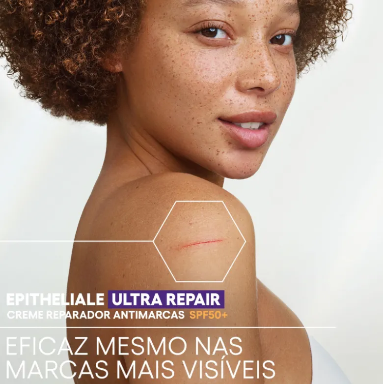 A-Derma EPITHELIALE Ultra Repair SPF50+ Creme Antimarcas 100ml