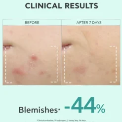 Apivita Just Bee Clear Sérum Anti-Imperfeições 30ml | Atenua Marcas Acne e Afina a Pele