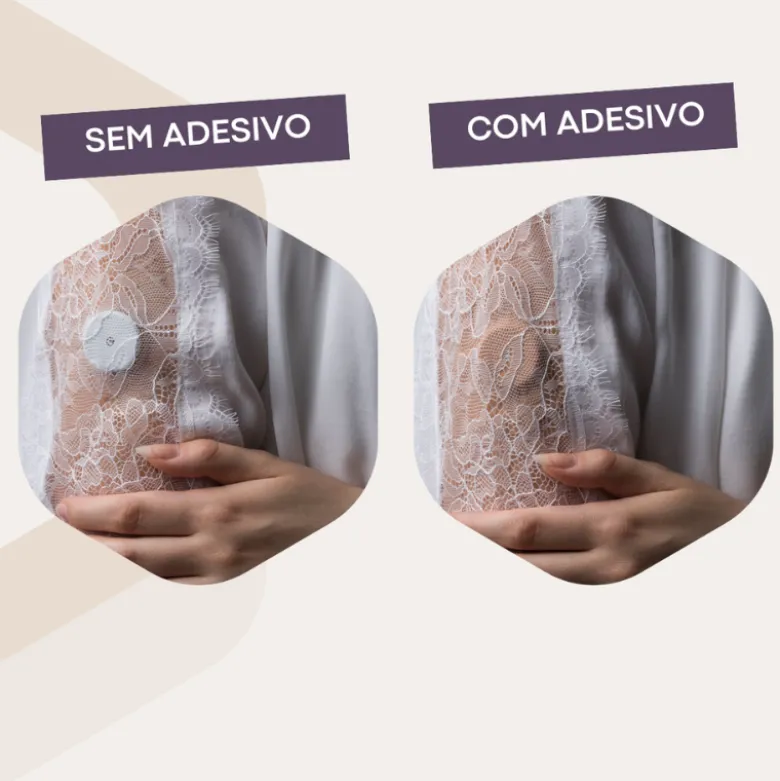 Capteur Protect Underpatch Cânula Medtronic Bege Pack 4 | Adesivo Compatível com cânula Medtronic