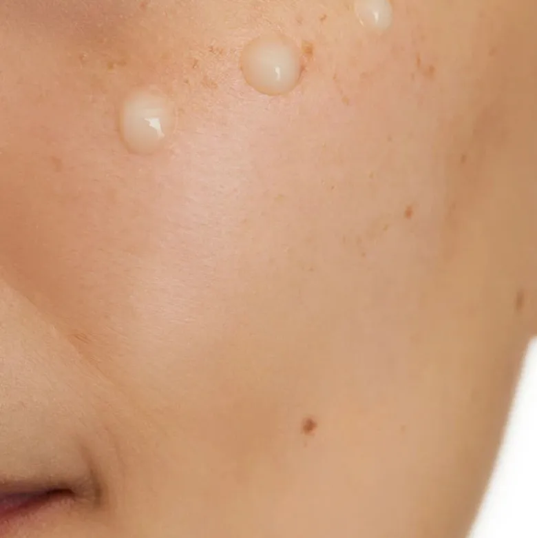 CeraVe Skin Renewing Sérum Vitamina C 30ml | Ilumina & Uniformiza a Pele | Com Ceramidas