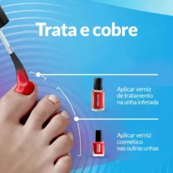 Excilor Forte Color Verniz Vermelho 30ml | Tratamento Antifúngico para Unhas | Cobre e Trata | Aplicação Diária
