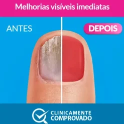 Excilor Forte Color Verniz Vermelho 30ml | Tratamento Antifúngico para Unhas | Cobre e Trata | Aplicação Diária