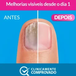 Excilor Forte Verniz 30ml | Tratamento Diário 24h para Fungos nas Unhas