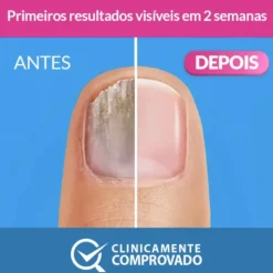 Excilor Solução Tratamento Antifúngico para Unhas 3,3ml | Com Pincel | Resultados em 2 Semanas