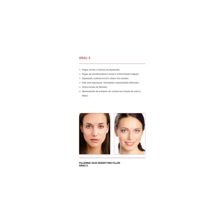 Fillerina 12HA Densifying-Filler Creme Dia 50ml Grau 3 | Preenchimento