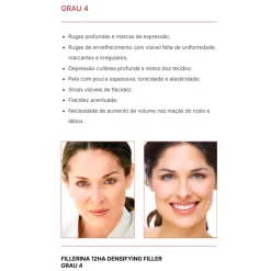 Fillerina 12HA Grau 4 Creme Dia 50ml | Efeito Lifting e Preenchedor | Rugas Profundas e Flacidez
