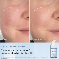 Medik8 Niacinamide Peptides Sérum 30ml | Reduz imperfeições e poros