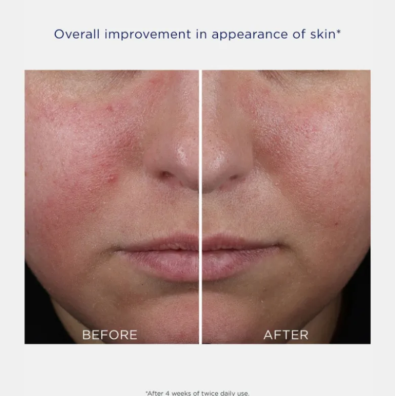 NEOSTRATA Mandelic Clarifying Hydragel 50ml | Hidratante em Gel para Pele Oleosa e Acne