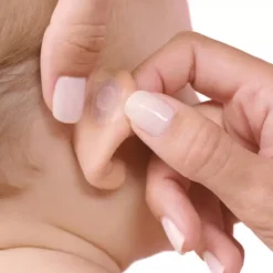 Otostick Baby Corretor Estético para Orelhas 8 Unidades + Touca