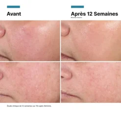 SkinCeuticals Advanced RGN-6 | Creme Pós-Laser 50ml