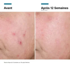 SkinCeuticals Advanced RGN-6 | Creme Pós-Laser 50ml