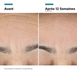 SkinCeuticals Advanced RGN-6 | Creme Pós-Laser 50ml