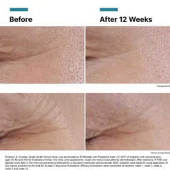SkinCeuticals P-TIOX Sérum 30ml