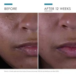 SkinCeuticals Silymarin CF 30ml