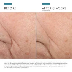 SkinCeuticals Triple Lipid Restore 2:4:2 48ml