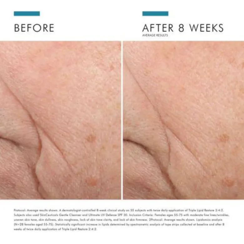 SkinCeuticals Triple Lipid Restore 2:4:2 48ml