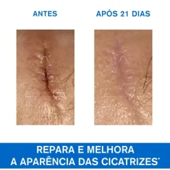 Uriage Bariéderm-CICA Creme 100ml