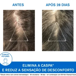 Uriage DS Hair Champô Caspa 500ml | Caspa Seca e Oleosa
