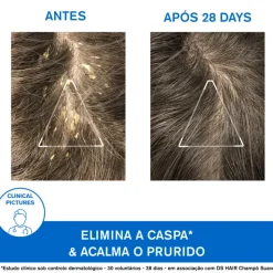 Uriage DS Hair Champô de Tratamento Queratorregulador 150ml