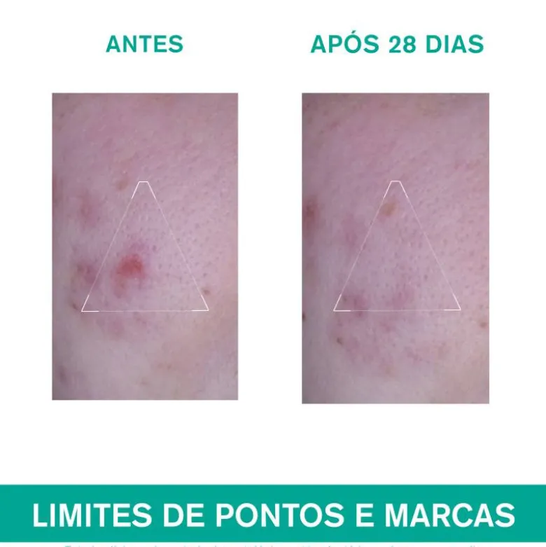 Uriage Hyséac 3-REGUL+ Creme 40ml