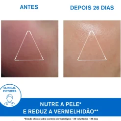 Uriage Xémose Creme Rosto 40ml